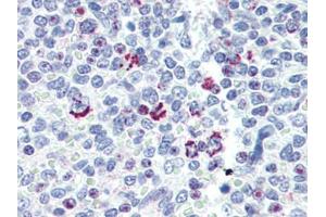 Human Spleen (formalin-fixed, paraffin-embedded) stained with LIN28Bfollowed by biotinylated goat anti-rabbit IgG secondary antibody, alkaline phosphatase-streptavidin and chromogen. (LIN28B anticorps  (N-Term))