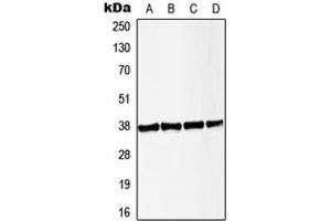 Western blot analysis of LAT (pY191) expression in HeLa PMA-treated (A), Jurkat CD3-treated (B), Raw264. (LAT anticorps  (C-Term, pTyr191))