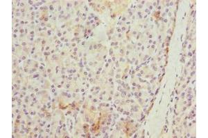 Immunohistochemistry of paraffin-embedded human pancreatic tissue using ABIN7175794 at dilution of 1:100 (WDR74 anticorps  (AA 111-366))