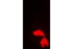 Immunofluorescent analysis of PA28 gamma staining in Hela cells.
