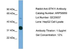 WB Suggested Anti-STK11  Antibody Titration: 0. (LKB1 anticorps  (C-Term))