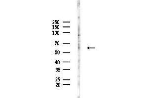 anti-Acyl-CoA Binding Domain Containing 5 (ACBD5) (Internal Region) antibody