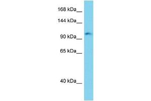 Host: Rabbit Target Name: Erc2 Sample Type: Mouse Liver lysates Antibody Dilution: 1. (ERC2 anticorps  (C-Term))