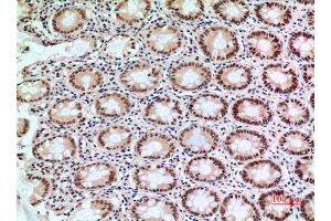 Immunohistochemistry (IHC) analysis of paraffin-embedded Human Colon, antibody was diluted at 1:100.