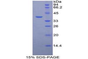 SDS-PAGE (SDS) image for Calcitonin (Calca) (AA 85-116) protein (His tag,GST tag) (ABIN1877283)