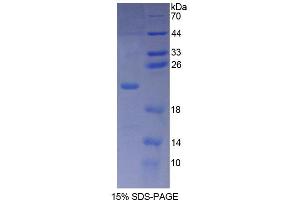 Image no. 1 for Phospholipase C beta 3, Phosphoinositide Specific (AA 318-468) protein (His tag) (ABIN6238765) (Phospholipase C beta 3, Phosphoinositide Specific (AA 318-468) protein (His tag))