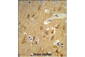 Formalin-fixed and raffin-embedded human brain tissue reacted with TSN12 Antibody (C-term), which was peroxidase-conjugated to the secondary antibody, followed by DAB staining. (TSPAN12 anticorps  (C-Term))