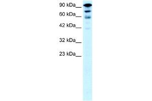 WB Suggested Anti-KIF5A Antibody Titration:  0. (KIF5A anticorps  (Middle Region))
