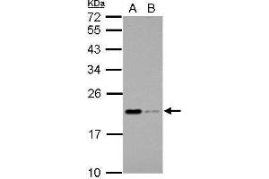 WB Image Sample (30 ug of whole cell lysate) A: THP-1 B: HL-60 12% SDS PAGE antibody diluted at 1:1000 (Apolipoprotein M anticorps)
