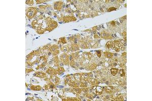 Immunohistochemistry of paraffin-embedded human stomach using ATG5 antibody (ABIN5997274) at dilution of 1/100 (40x lens). (ATG5 anticorps)