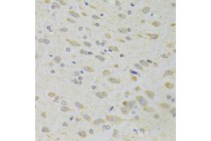 Immunohistochemistry of paraffin-embedded rat brain using PPP2R1B Antibody (ABIN2564666) at dilution of 1:100 (40x lens). (PPP2R1B anticorps)