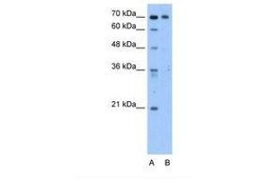 Image no. 1 for anti-Chromosome 9 Open Reading Frame 96 (C9orf96) (AA 581-630) antibody (ABIN321564) (C9orf96 anticorps  (AA 581-630))