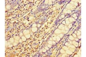 Immunohistochemistry of paraffin-embedded human colon tissue using ABIN7151556 at dilution of 1:100 (ELOVL1 anticorps  (AA 82-175))
