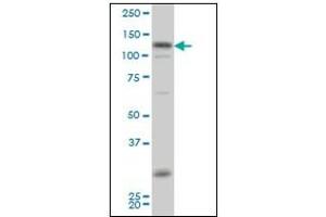 Western Blotting (WB) image for anti-Homeodomain Interacting Protein Kinase 2 (HIPK2) antibody (ABIN781914)