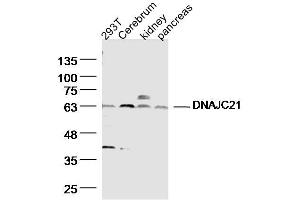 Lane 1: HT29 Cell lysates; Lane 2: mouse Cerebrum Cell lysates; Lane 3: Mouse kidney lysates; Lane 4: Mouse pancreas lysates; probed with DNAJC21 Polyclonal Antibody, unconjugated (bs-14387R) at 1:300 overnight at 4°C followed by a conjugated secondary antibody for 60 minutes at 37°C. (DNAJC21 anticorps  (AA 11-120))