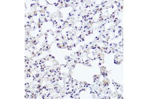 Immunohistochemistry of paraffin-embedded rat lung using NFIB Rabbit pAb (ABIN7268973) at dilution of 1:250 (40x lens).