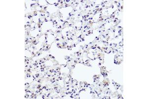 Immunohistochemistry of paraffin-embedded rat lung using NFIB Rabbit pAb (ABIN7268973) at dilution of 1:250 (40x lens). (NFIB anticorps  (C-Term))