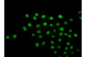 Immunofluorescence staining of Hela cells with ncrHU at 1:1, counter-stained with DAPI. (Histone H2B anticorps)
