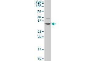 DECR2 MaxPab polyclonal antibody. (DECR2 anticorps  (AA 1-292))