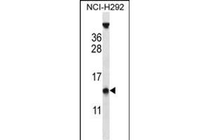 PYDC1 Antibody (Center) (ABIN657048 and ABIN2846215) western blot analysis in NCI- cell line lysates (35 μg/lane). (PYDC1 anticorps  (AA 13-42))