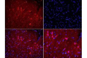 Formalin-fixed and paraffin embedded rat brain labeled with Rabbit Anti-NOX2/gp91phox Polyclonal Antibody, Unconjugated used at 1:200 dilution for 40 minutes at 37°C. (CYBB anticorps  (AA 501-570))