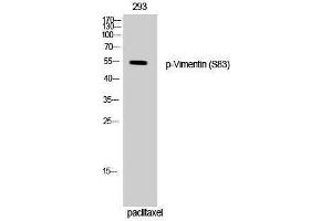 Western Blotting (WB) image for anti-Vimentin (VIM) (pSer83) antibody (ABIN3179696) (Vimentin anticorps  (pSer83))