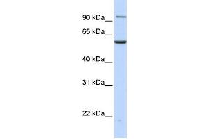 WB Suggested Anti-TNPO2 Antibody Titration: 0. (TNPO2 anticorps  (N-Term))
