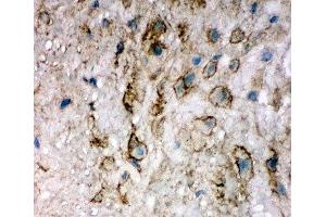 IHC-F testing of EIF6 antibody and human placenta tissue (EIF6 anticorps  (Middle Region))