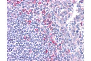 DLL1 antibody was used for immunohistochemistry at a concentration of 4-8 ug/ml. (DLL1 anticorps)