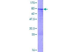 Image no. 1 for Keratin 7 (KRT7) (AA 1-469) protein (GST tag) (ABIN1309020)