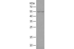 Western Blotting (WB) image for MORC Family CW-Type Zinc Finger 3 (MORC3) (AA 1-290) protein (His-IF2DI Tag) (ABIN7124019)