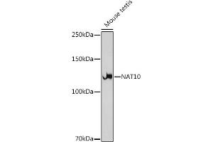 Western blot analysis of extracts of Mouse testis, using N antibody (ABIN7268774) at 1:1000 dilution. (NAT10 anticorps)