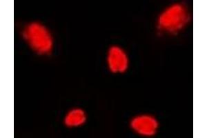 Immunofluorescent analysis of p38 staining in Jurkat cells.