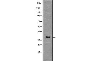 Western blot analysis of CD134 using COLO205 whole  lysates.