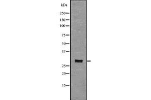 Western blot analysis of CD134 using COLO205 whole  lysates. (TNFRSF4 anticorps  (C-Term))