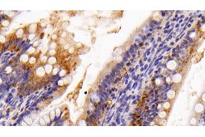 Detection of GAL4 in Rat Colon Tissue using Polyclonal Antibody to Galectin 4 (GAL4)