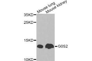 Western blot analysis of extracts of various cell lines, using G0S2 Antibody. (G0S2 anticorps)
