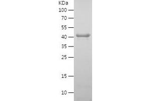 Western Blotting (WB) image for Sirtuin 2 (SIRT2) (AA 2-389) protein (His tag) (ABIN7125105)