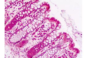 Human Colon: Formalin-Fixed, Paraffin-Embedded (FFPE) (PUM2 anticorps  (N-Term))