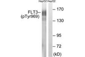 Western blot analysis of extracts from HepG2 cells treated with Na3VO4 0. (FLT3 anticorps  (pTyr969))