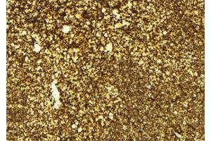 ABIN6269035 at 1/100 staining Mouse spleen tissue by IHC-P.