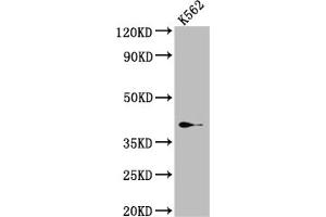 Western Blot Positive WB detected in: K562 whole cell lysate All lanes: SAE1 Antibody at 1:1000 Secondary Goat polyclonal to rabbit IgG at 1/50000 dilution Predicted band size: 39, 30, 34 kDa Observed band size: 39 kDa (Recombinant SAE1 anticorps)