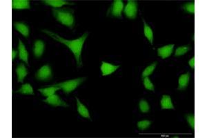 Immunofluorescence of purified MaxPab antibody to DPF2 on HeLa cell.