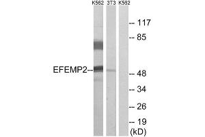Western Blotting (WB) image for anti-Fibulin 4 (FBLN4) (Internal Region) antibody (ABIN1851282) (FBLN4 anticorps  (Internal Region))