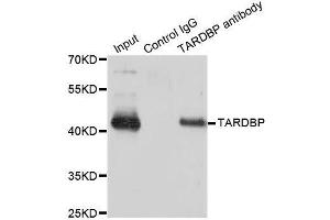 Immunoprecipitation analysis of 200ug extracts of SW620 cells using 3ug TARDBP antibody.