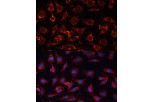Immunofluorescence analysis of C6 cells using PDH Polyclonal Antibody (ABIN6132882, ABIN6145379, ABIN6145381 and ABIN6225274) at dilution of 1:100 (40x lens). (PDHA2 anticorps  (AA 119-388))