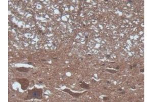 anti-Calcium/calmodulin-Dependent Protein Kinase II alpha (CAMK2A) (AA 1-478) antibody