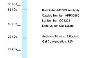 WB Suggested Anti-MESP1 Antibody   Titration: 1. (MESP1 anticorps  (C-Term))