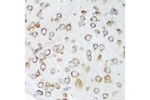 Immunohistochemistry of paraffin-embedded mouse brain using NOTCH2 antibody at dilution of 1:100 (40x lens). (NOTCH2 anticorps)