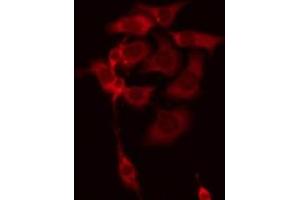ABIN6278591 staining Hela by IF/ICC. (C18orf8 anticorps  (C-Term))